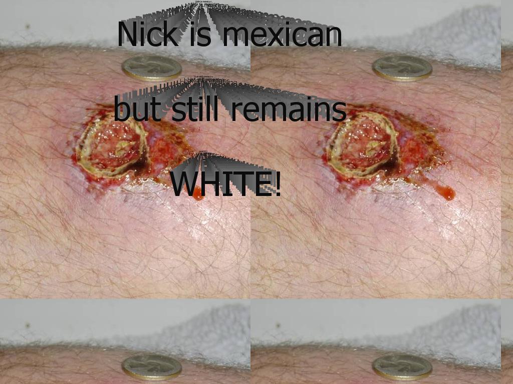 nicksuckscock