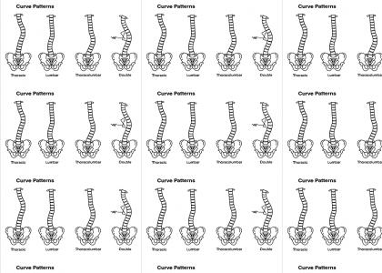 Scoliosis