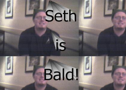 Seth is Bald!
