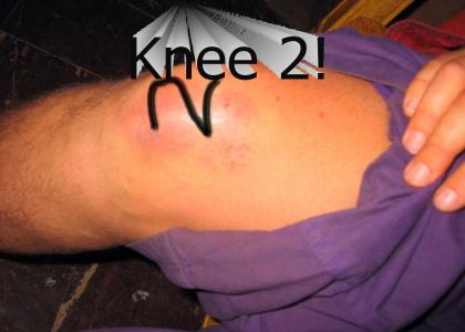 Knee 2