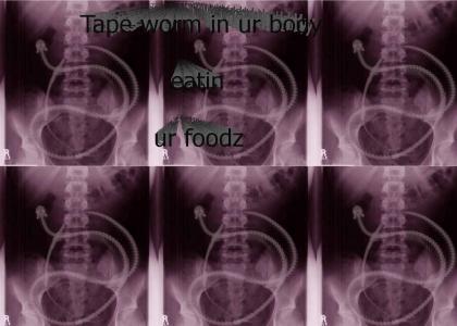 Tape worm in ur body eathing ur foodz