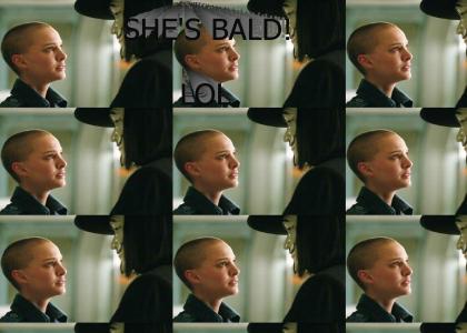 natalie's bald