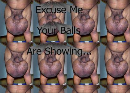 Your balls are showing!