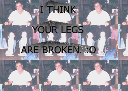 broken legs