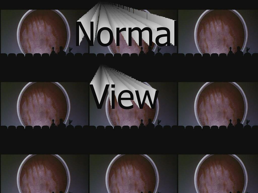 normalview