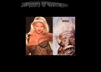 Anna Nicole Smith 20 years later of trim spa Before and After