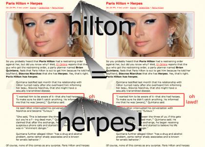 Paris Hilton = Herpes!