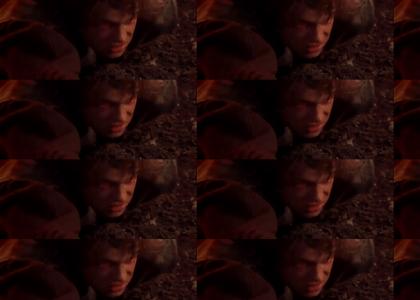 Anakin is Burning in the sunlight